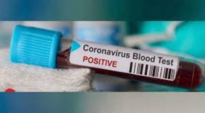 हेटौँडामा चार जनामा ‘आरडिटी पोजेटिभ’