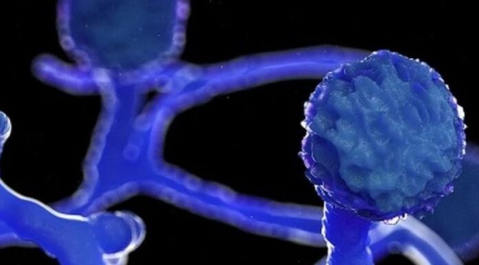 कालो ढुसीको सङ्क्रमणबाट कैलालीमा एकको मृत्यु